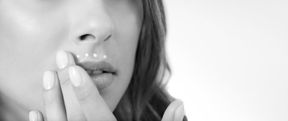 Woman´s face with melasma